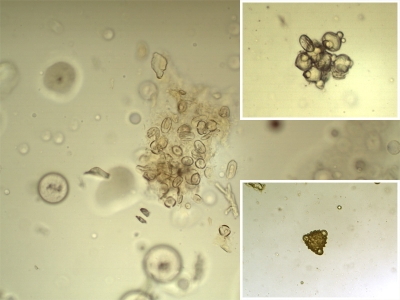 Удивительные фотографии под микроскопом 05 Июль 2013 15:38 первое Удивительные фотографии под микроскопом 05 Июль 2013 15:38 первое